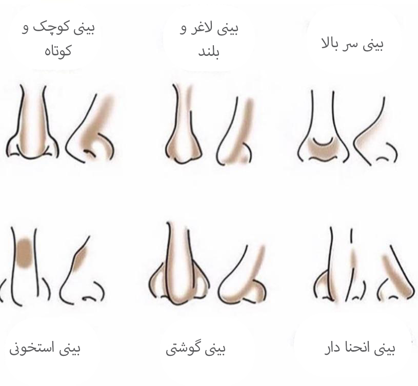 راهنمای کانتور انواع بینی 